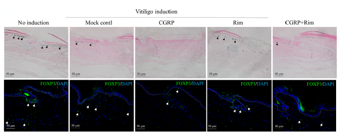α-CGRP (human) (Calcitonin gene-related peptide) | 血管舒张剂 | MCE
