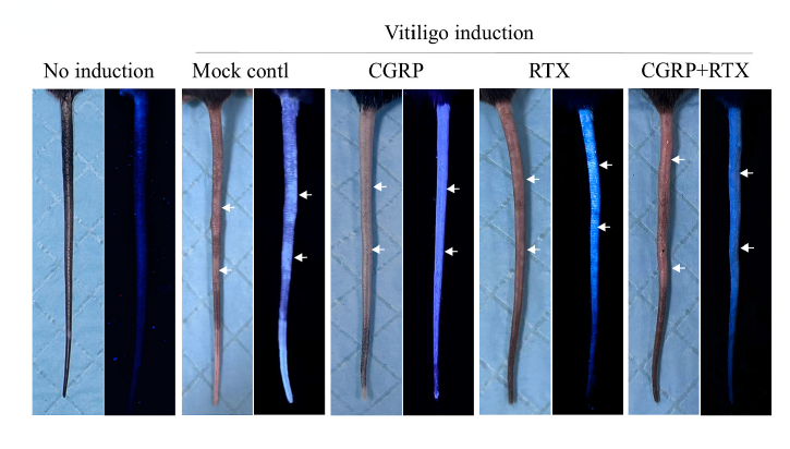 α-CGRP (human) (Calcitonin gene-related peptide) | 血管舒张剂 | MCE