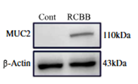 Repsox RepSox (E-616452) | TGF-β-RI/ALK5抑制剂 | MCE
