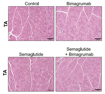 Bimagrumab (Anti-ACVR2B Reference Antibody，比玛卢单抗) - 仅供科研 | 人源化抗ACVR2B抗体 ...