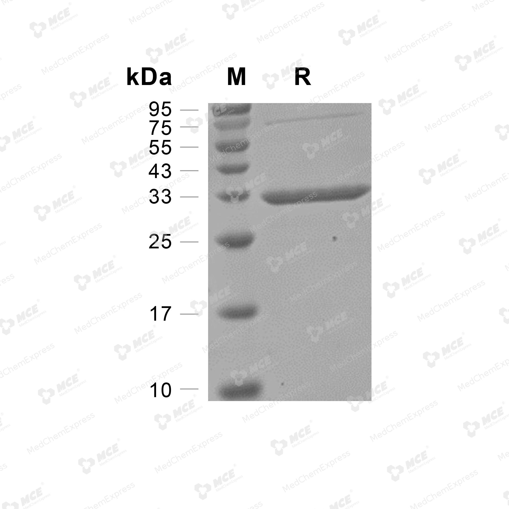 Collagen alpha-1(II) chain/COL2A1 蛋白, Human (HEK293, His) | MCE